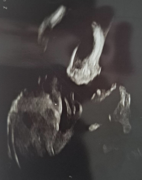 Due Jan 2025