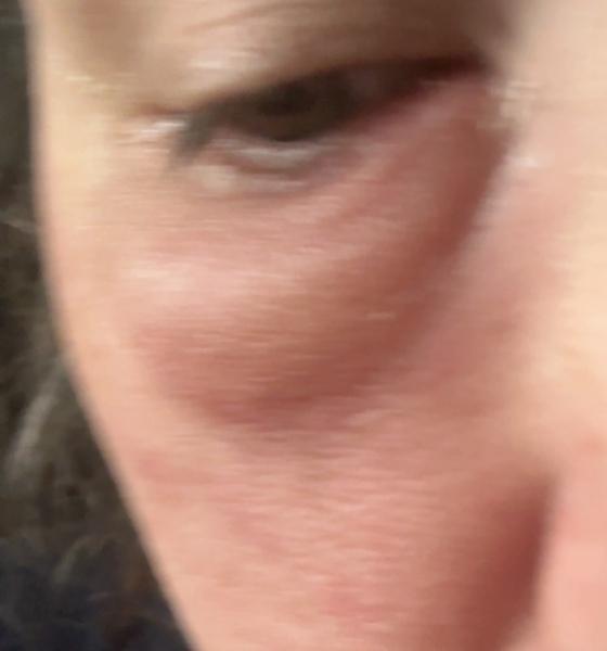 Would a pharmacist help with this?