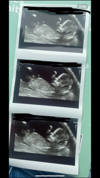 Gender Guesses? 🥰