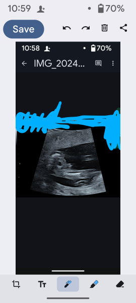 Gender of scan images