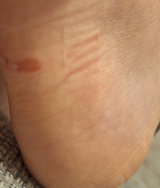 Cut on heel