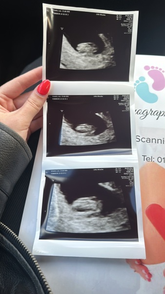 7 weeks 6 days ultrasound