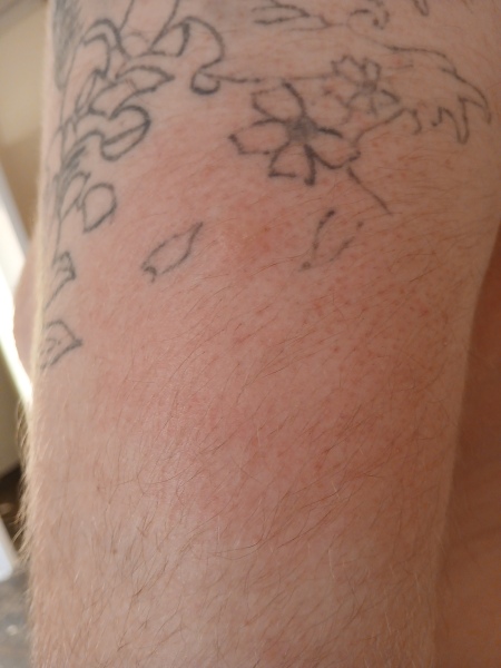 Is this a bullseye bite mark?