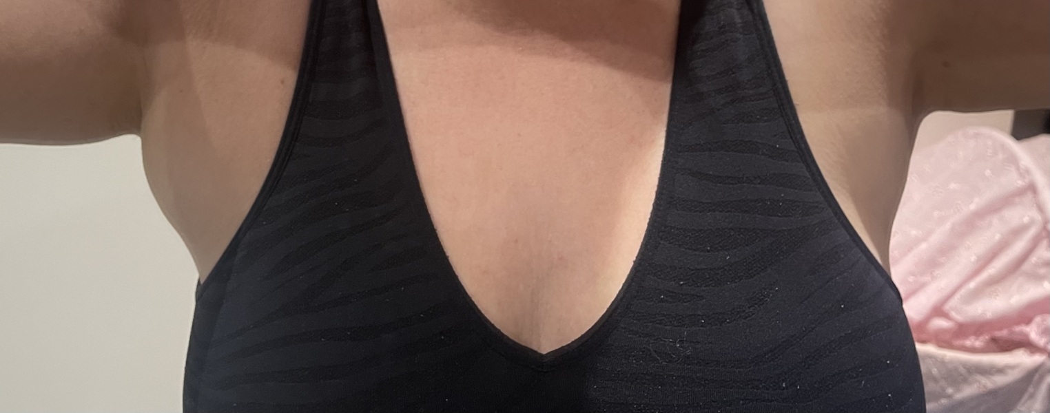 Swollen area under left armpit? Photo attached