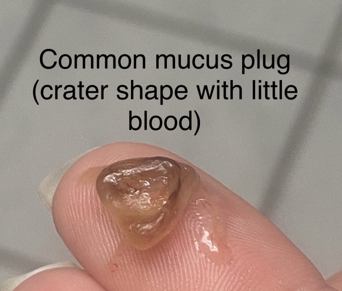 Any idea what this could be...GROSS PIC INCLUDED