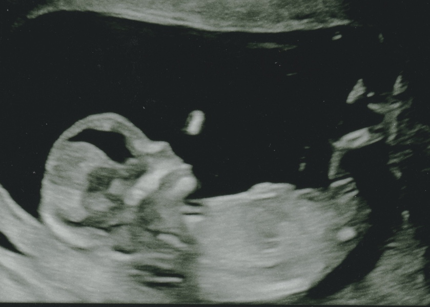 Gender theories - Boy or Girl
