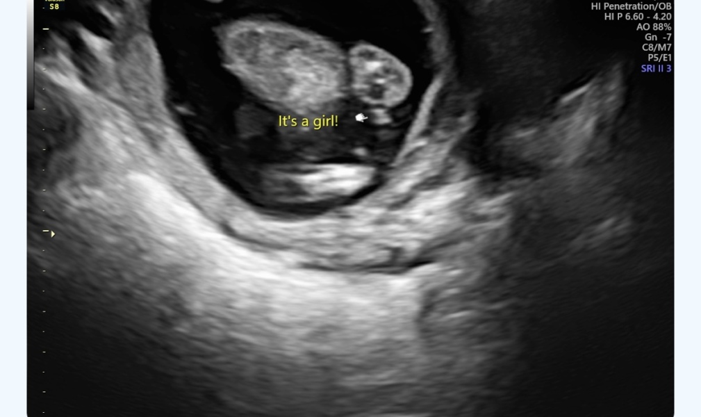 Definitely a girl ?