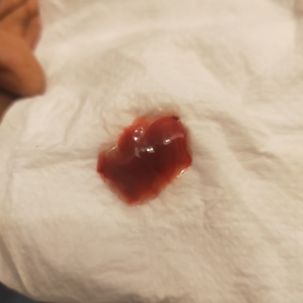 TMI - is this my mucus plug?
