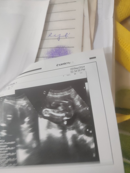 Did they tell us the wrong gender?