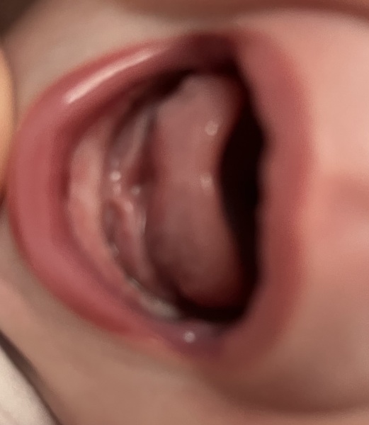 Teething?