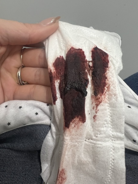 TW blood. Is this normal?