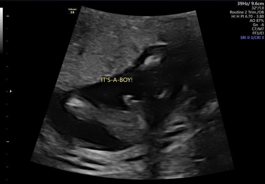 Due February 2025 - Thread 3