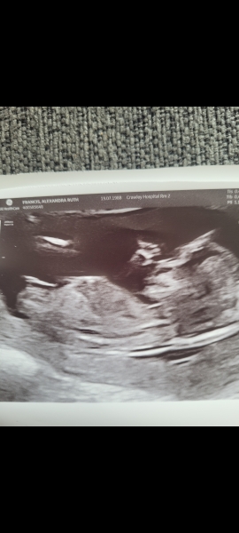 Any guesses on the sex?!