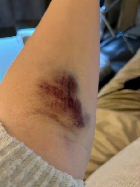 Been for a blood test, what has she done! Photo attached