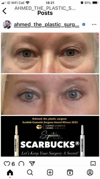 Eye aesthetics - need help!