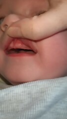 Baby's gums swollen for weeks...but no teeth!