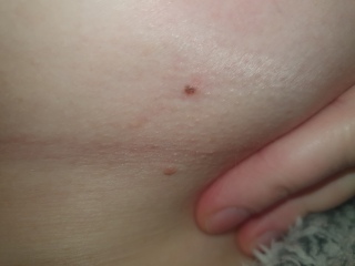 New mole
