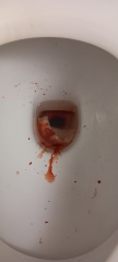 Really heavy period *** Gross photo warning***