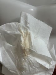 Brown on toilet paper - worried