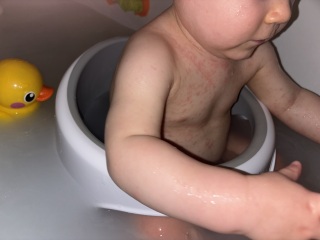 1 year old potentially has chicken pox. Wife pregnant with baby #2