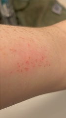 Advice or similar situations please