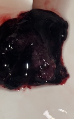 Help, possible miscarriage???