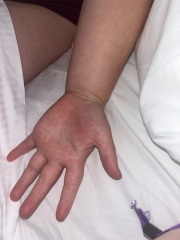 Sick with tonsillitis - help please!