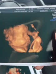 4D scan guess boy or girl?
