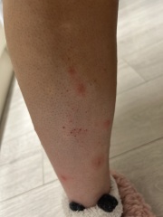 AIBU to go to hospital with this