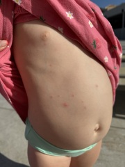 Toddler random spots