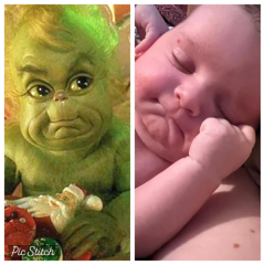 My mum told me to delete my ultrasound picture because baby is ugly