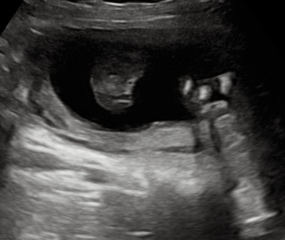 Is this a girl??