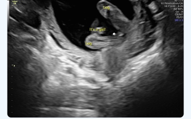 Definitely a girl ?