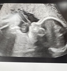 Can anyone guess the gender?
