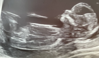 Can you guess the gender of my little one?