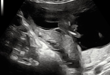 Is this a girl??
