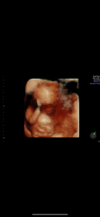 Due March 2025 thread 2