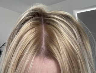 Any hairdressers here? I've bleached my hair orange!