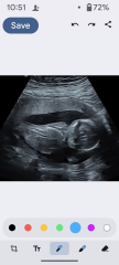 Gender of scan images