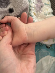 Does anyone recognise this rash/spots?