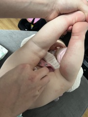 Weird spots that calm down and flair up