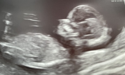 Can you guess the gender of my little one?