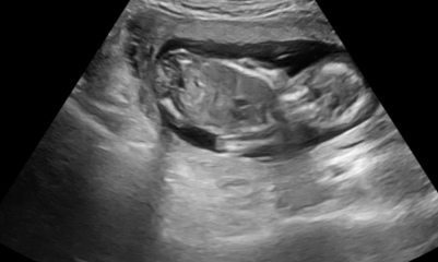 16 week gender scan