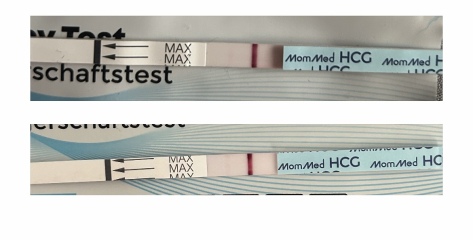 Evaps/no line progression? Pics included