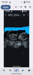 Gender of scan images