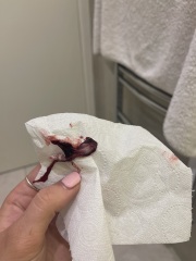 Is this a miscarriage?