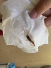 Could these be miscarriages?