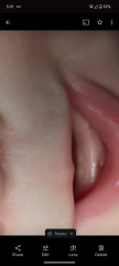 Teeth?