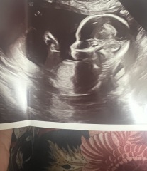 Boy or girl