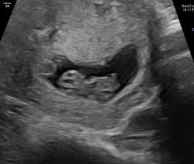Any gender guesses? :)
